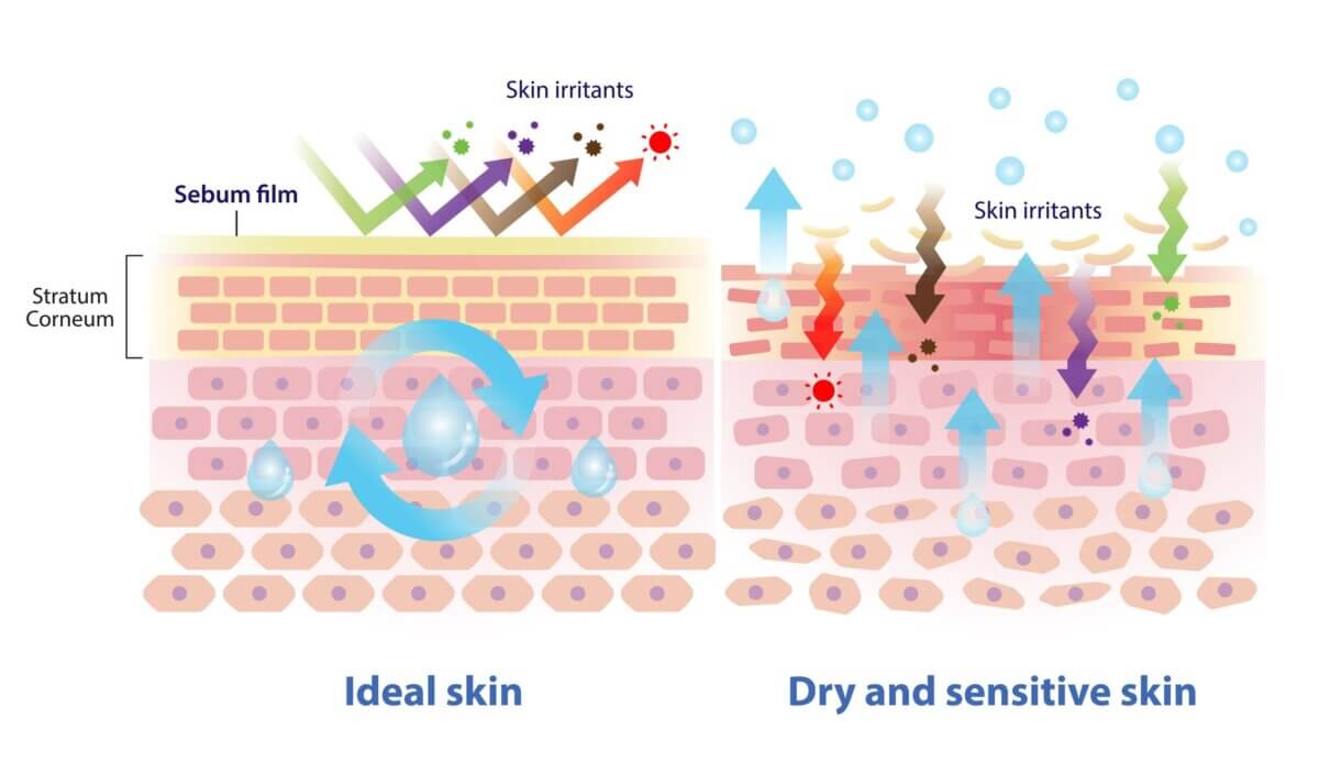 Skin Barrier Damage: Signs, Causes, and How to Repair It Naturally 2 skin barrier damage causing dryness and sensitivity