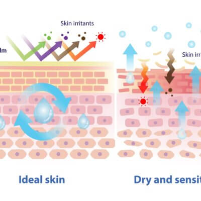 skin barrier damage causing dryness and sensitivity