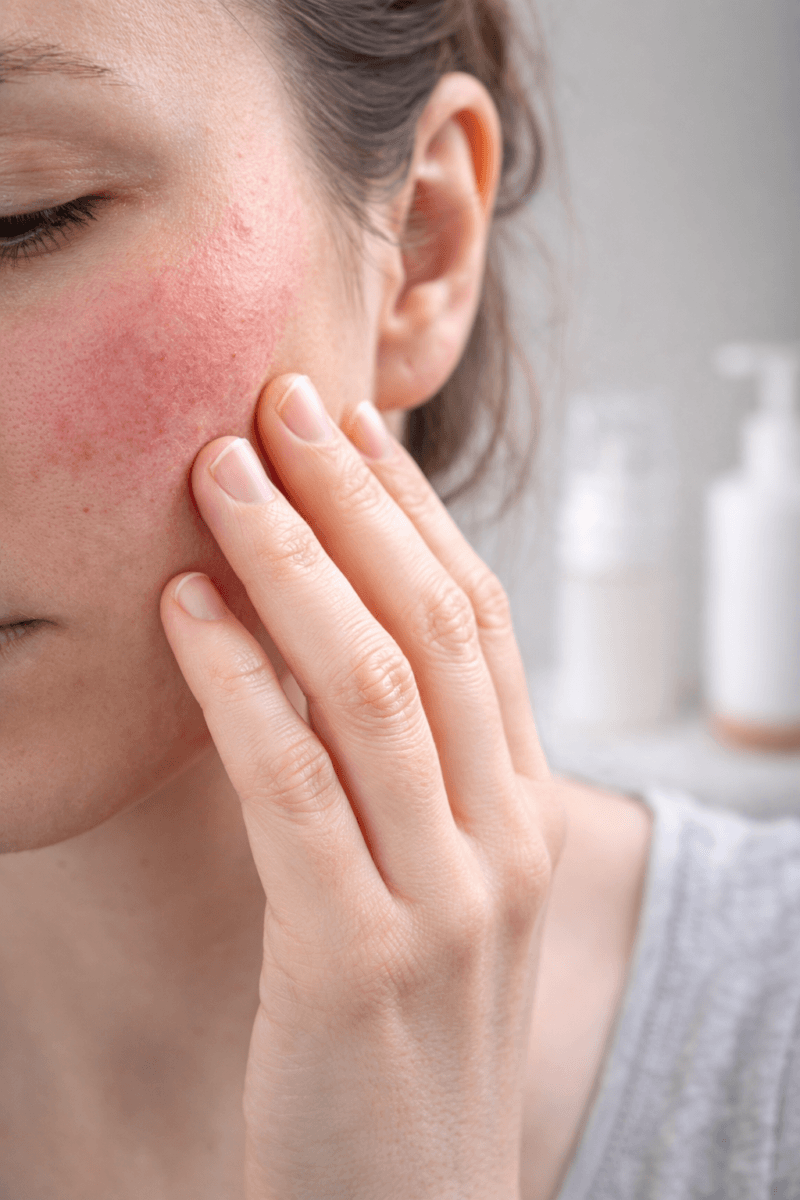 Why Your Skincare Is Causing Irritation (Even If It’s Natural) 2 skincare causing irritation on sensitive skin